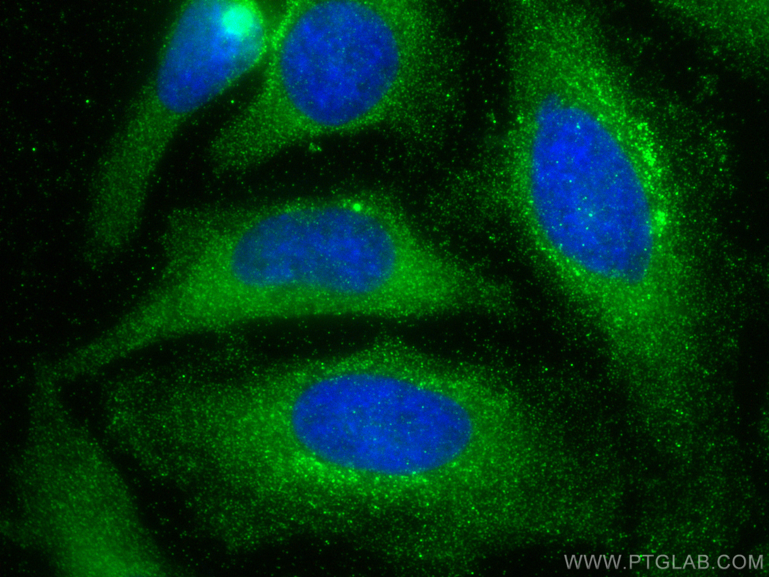 Immunofluorescence (IF) / fluorescent staining of HeLa cells using GLO1 Monoclonal antibody (68242-1-Ig)