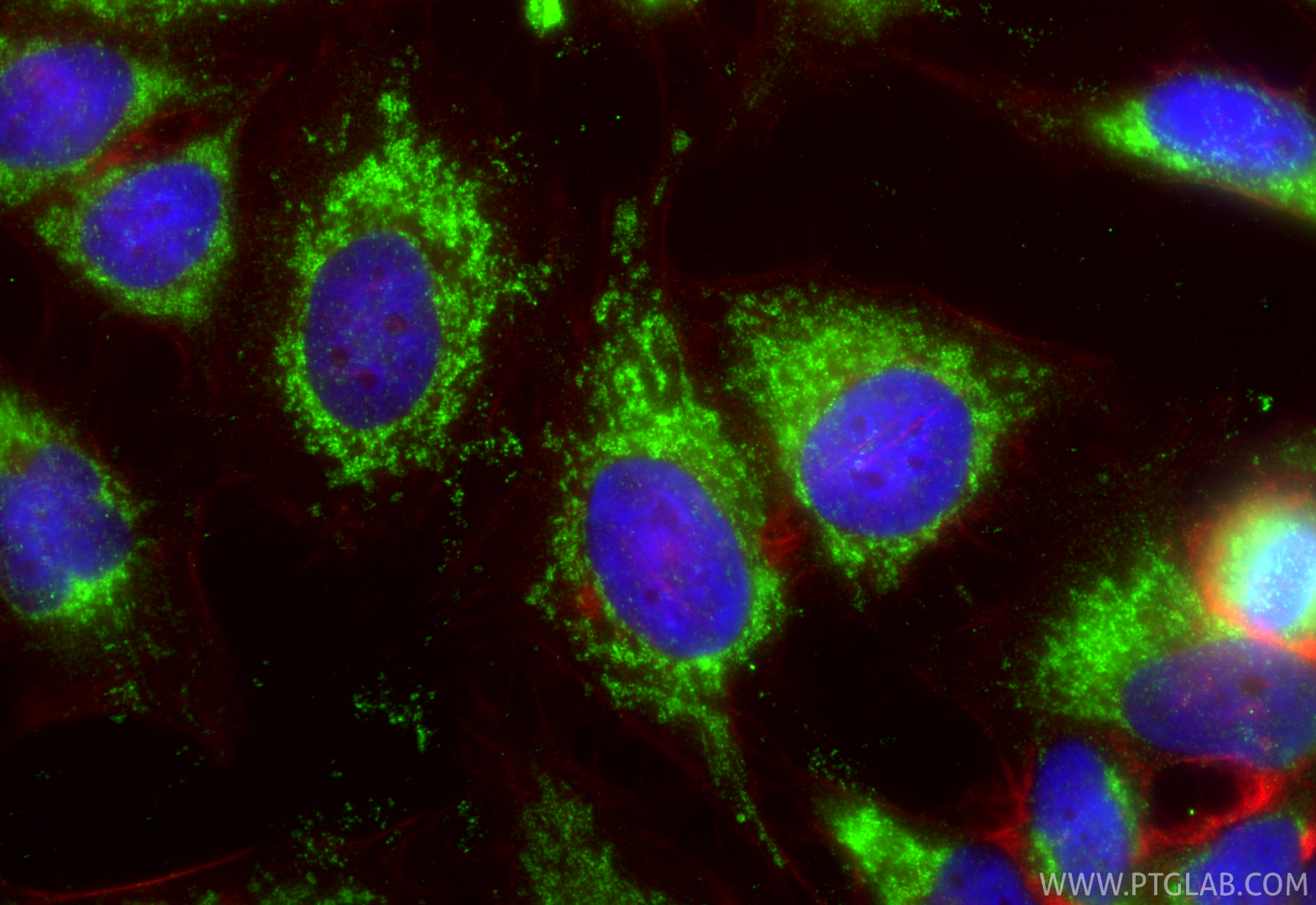 Immunofluorescence (IF) / fluorescent staining of HeLa cells using KGA/GAC Polyclonal antibody (12855-1-AP)