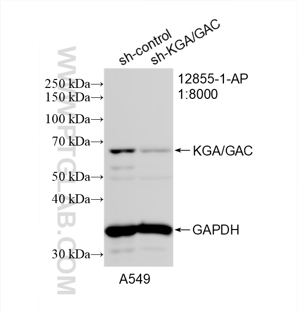 Western Blot (WB) analysis of A549 cells using KGA/GAC Polyclonal antibody (12855-1-AP)