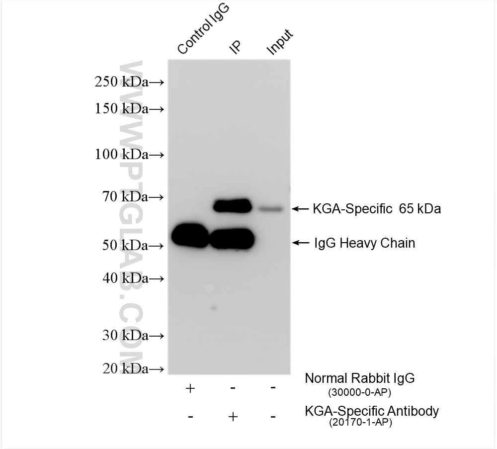 Immunoprecipitation (IP) experiment of HEK-293 cells using KGA-Specific Polyclonal antibody (20170-1-AP)