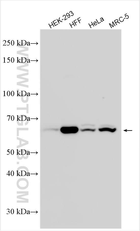 Western Blot (WB) analysis of various lysates using KGA-Specific Polyclonal antibody (20170-1-AP)