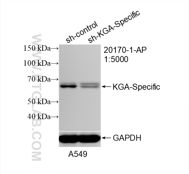 Western Blot (WB) analysis of A549 cells using KGA-Specific Polyclonal antibody (20170-1-AP)