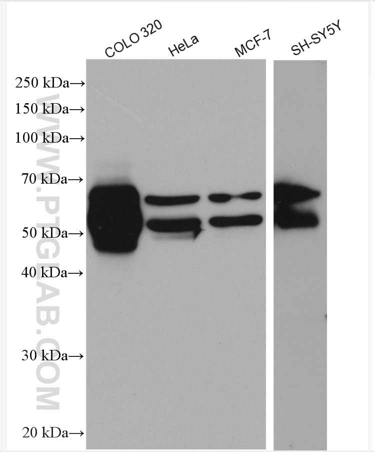 Western Blot (WB) analysis of various lysates using GLS Polyclonal antibody (29519-1-AP)