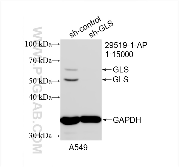 Western Blot (WB) analysis of A549 cells using GLS Polyclonal antibody (29519-1-AP)