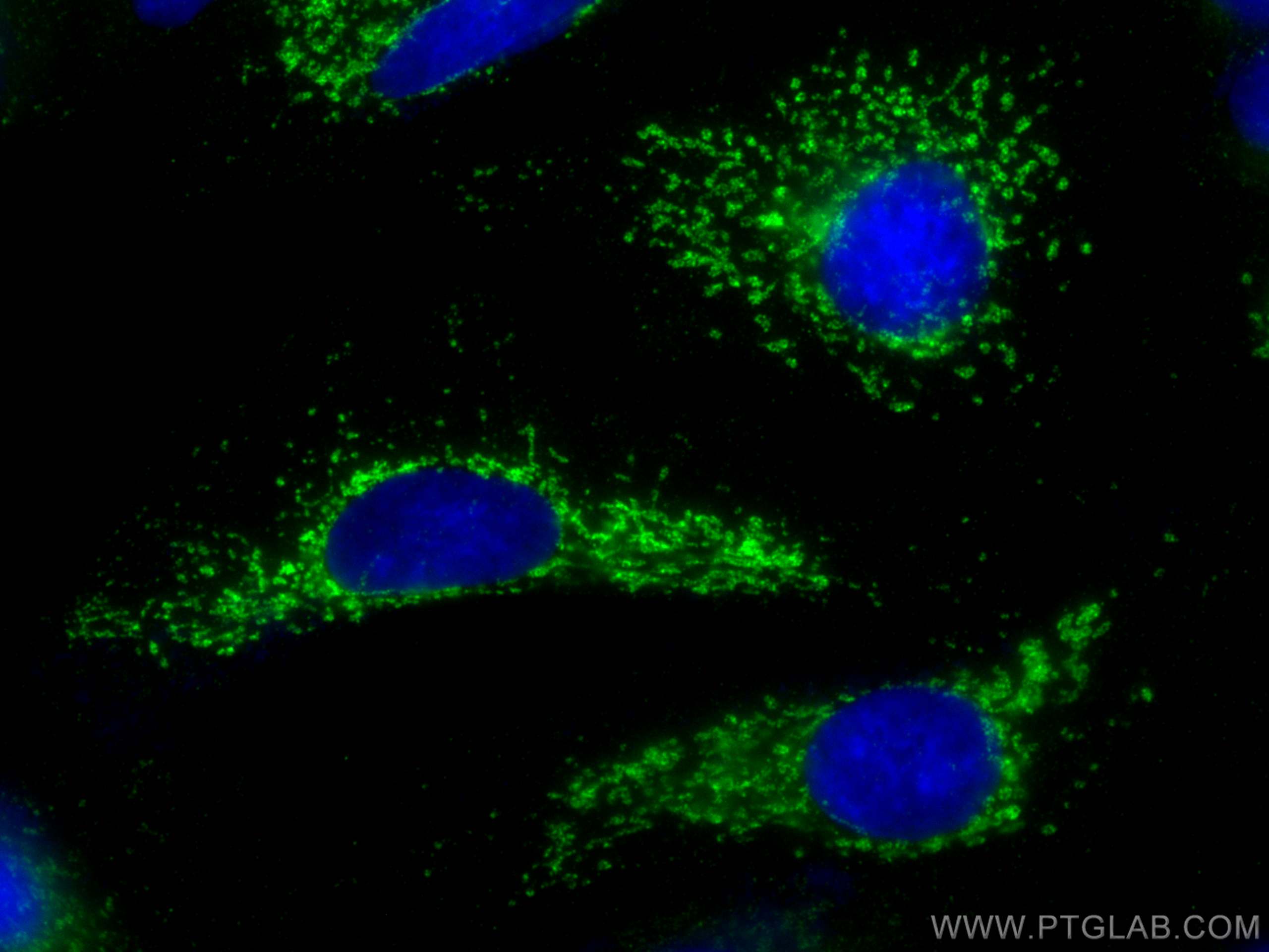 Immunofluorescence (IF) / fluorescent staining of A549 cells using GLS Recombinant antibody (81486-1-RR)