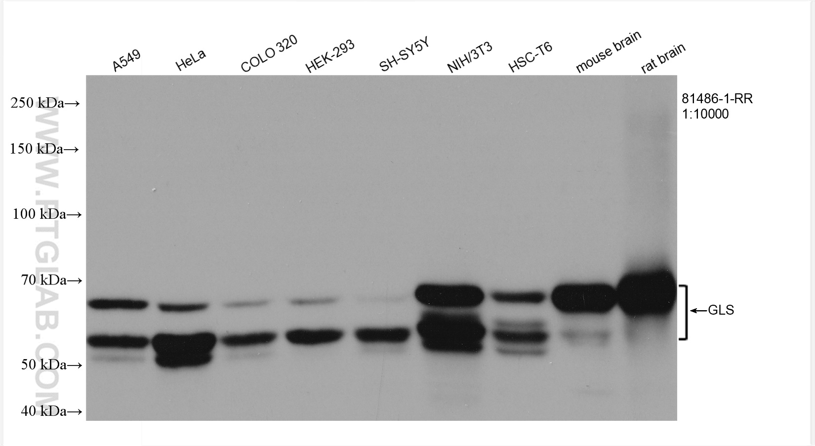 Western Blot (WB) analysis of various lysates using GLS Recombinant antibody (81486-1-RR)