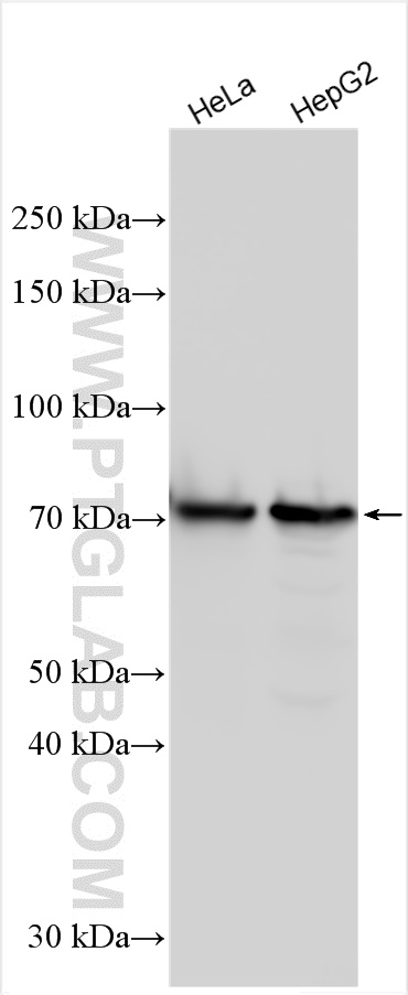 Western Blot (WB) analysis of various lysates using GLS2 Polyclonal antibody (20171-1-AP)