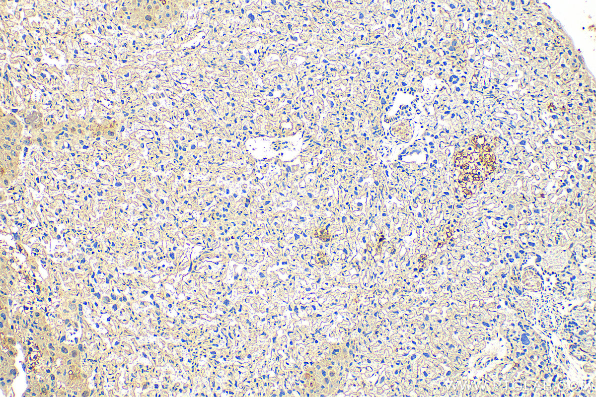 Immunohistochemistry (IHC) staining of mouse placenta tissue using GLT25D1 Polyclonal antibody (16768-1-AP)