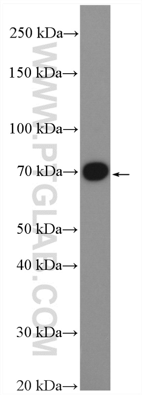 Western Blot (WB) analysis of SH-SY5Y cells using GLT25D1 Polyclonal antibody (16768-1-AP)