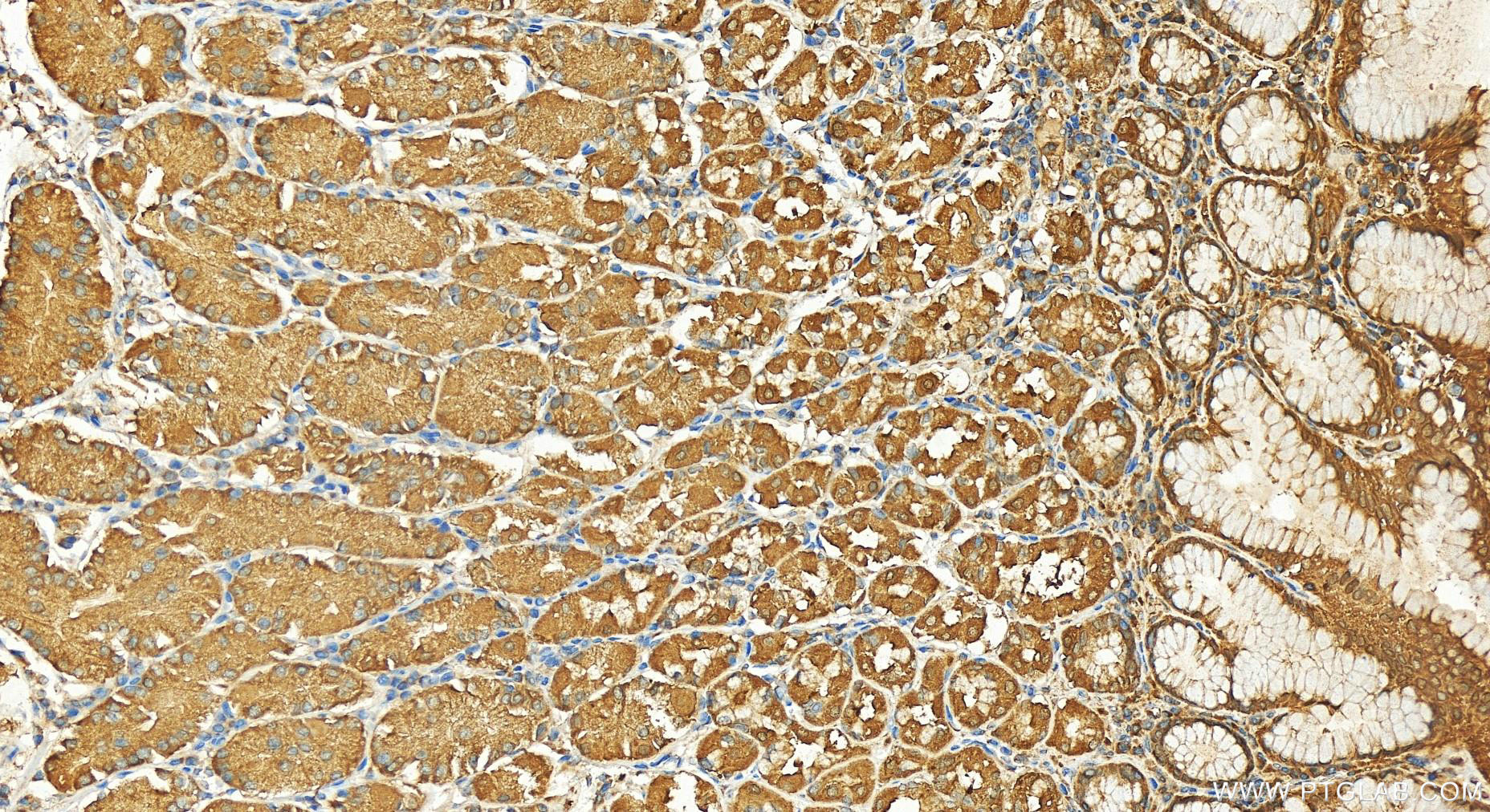 Immunohistochemistry (IHC) staining of human stomach tissue using GLTP Polyclonal antibody (10850-1-AP)