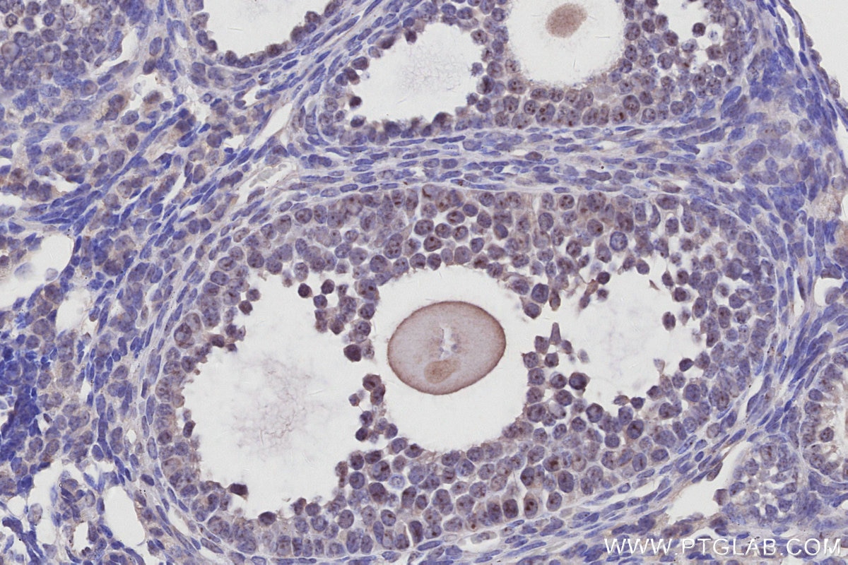 Immunohistochemistry (IHC) staining of mouse ovary tissue using GLTSCR2 Polyclonal antibody (27353-1-AP)