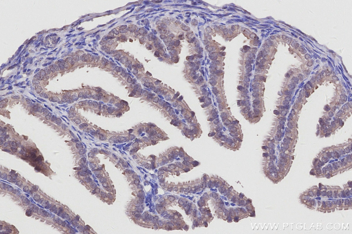Immunohistochemistry (IHC) staining of mouse ovary tissue using GLTSCR2 Polyclonal antibody (27353-1-AP)