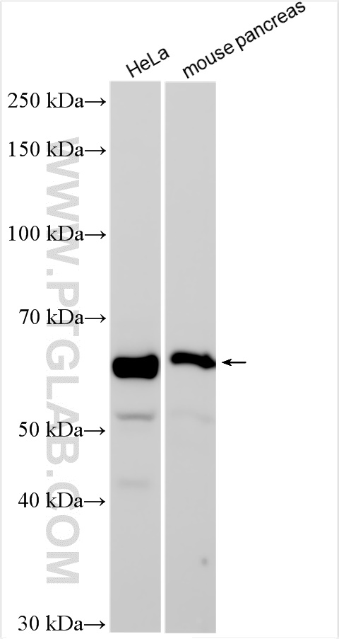 Western Blot (WB) analysis of various lysates using GLTSCR2 Polyclonal antibody (27353-1-AP)