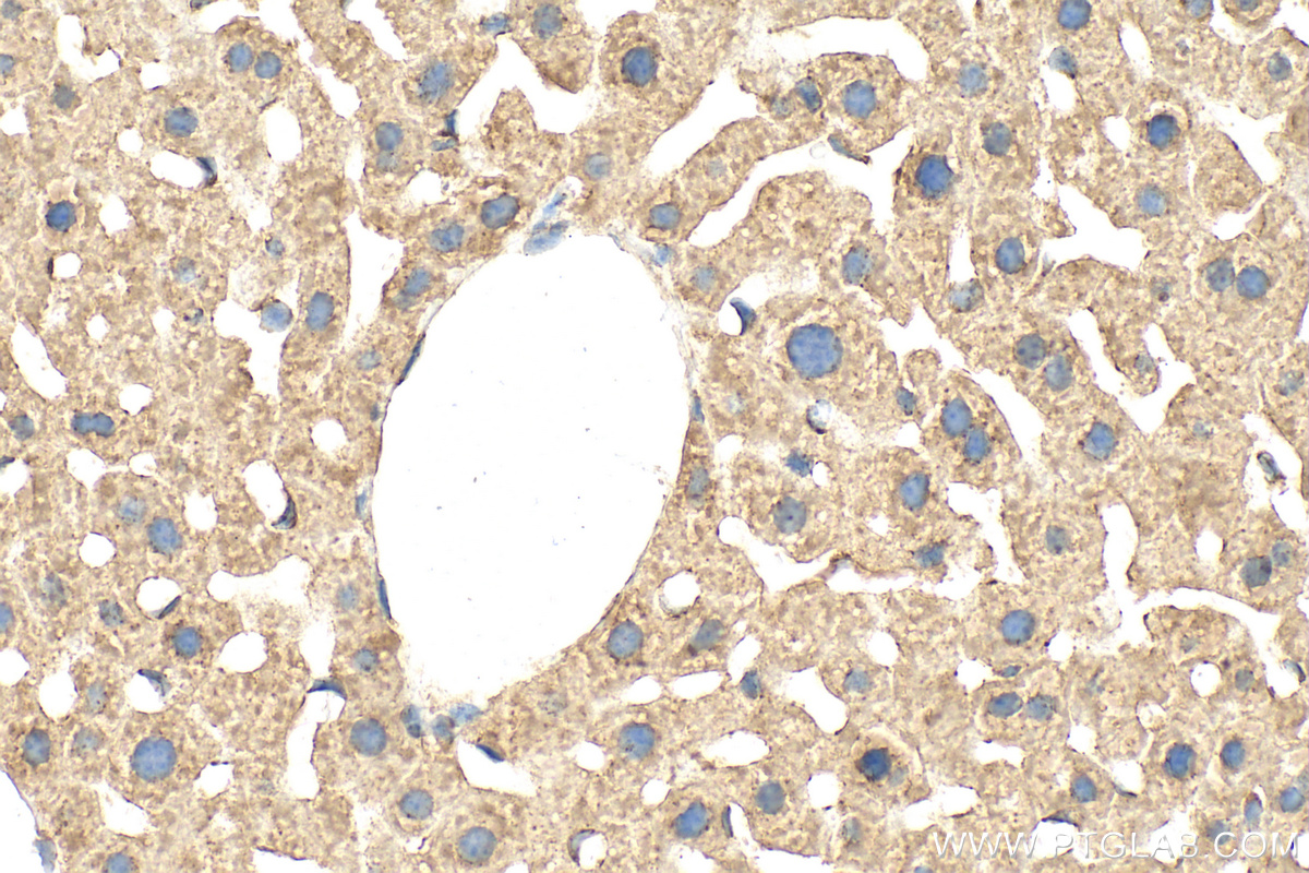 Immunohistochemistry (IHC) staining of mouse liver tissue using GLUD1 Polyclonal antibody (14299-1-AP)