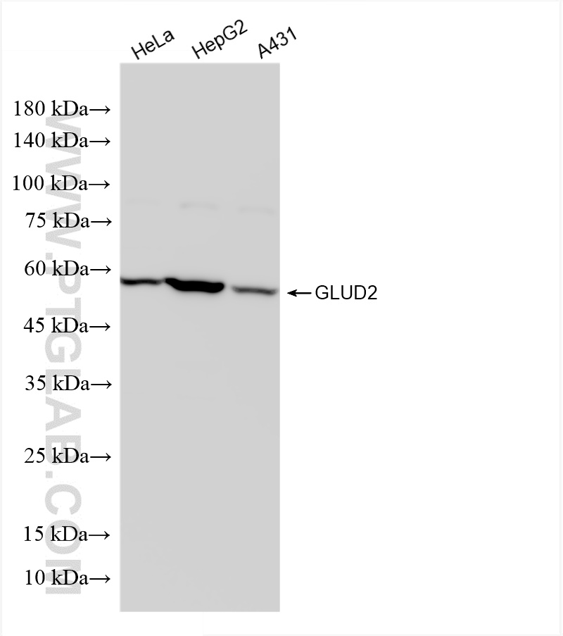 Western Blot (WB) analysis of various lysates using GLUD2 Recombinant antibody (85602-5-RR)
