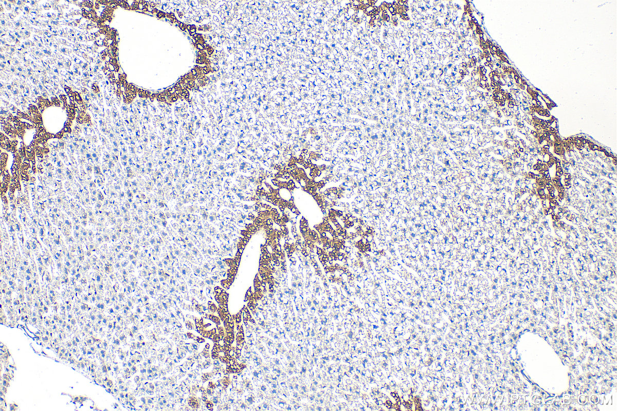 Immunohistochemistry (IHC) staining of mouse liver tissue using Glutamine Synthetase Polyclonal antibody (11037-2-AP)