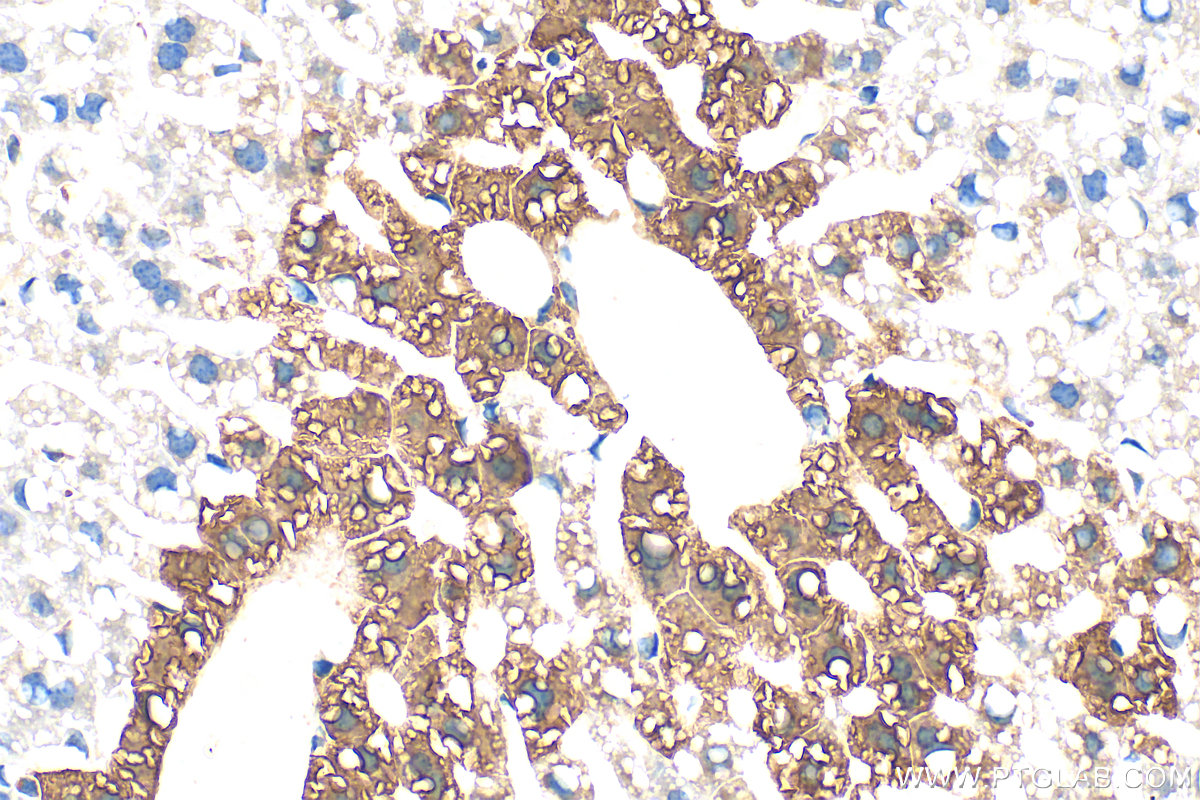 Immunohistochemistry (IHC) staining of mouse liver tissue using Glutamine Synthetase Polyclonal antibody (11037-2-AP)
