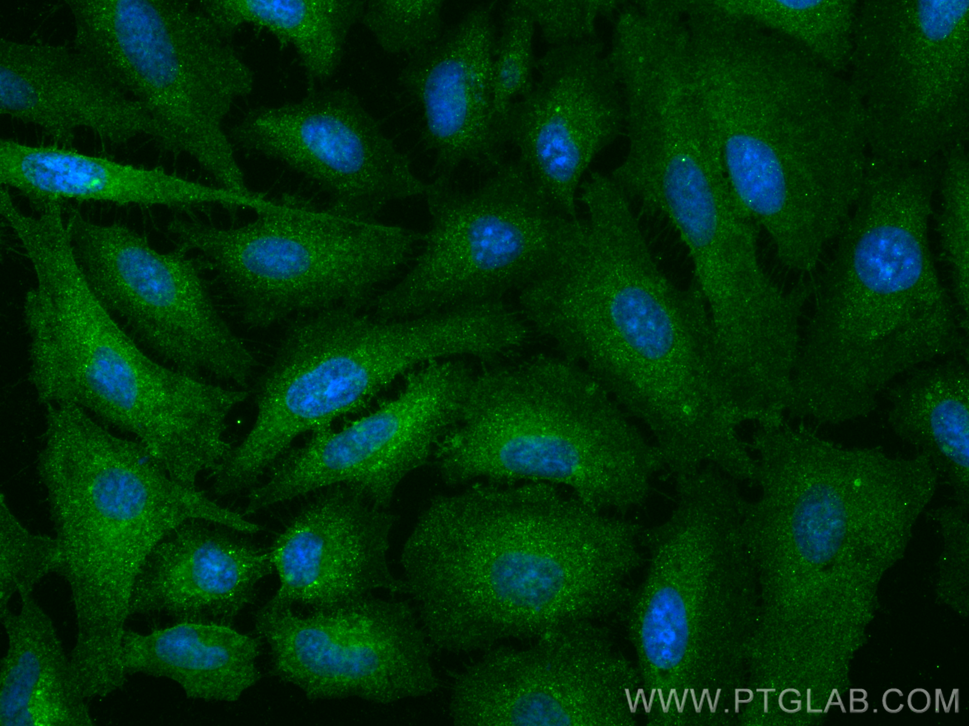 Immunofluorescence (IF) / fluorescent staining of HeLa cells using GLUT1 Monoclonal antibody (66290-1-Ig)