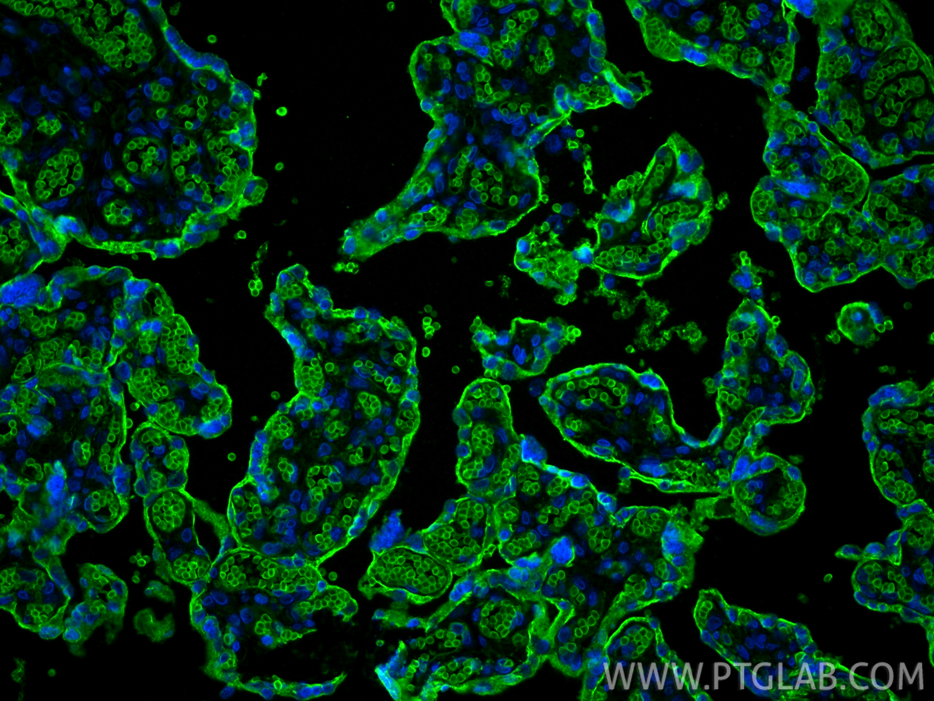 Immunofluorescence (IF) / fluorescent staining of human placenta tissue using GLUT1 Monoclonal antibody (66290-1-Ig)