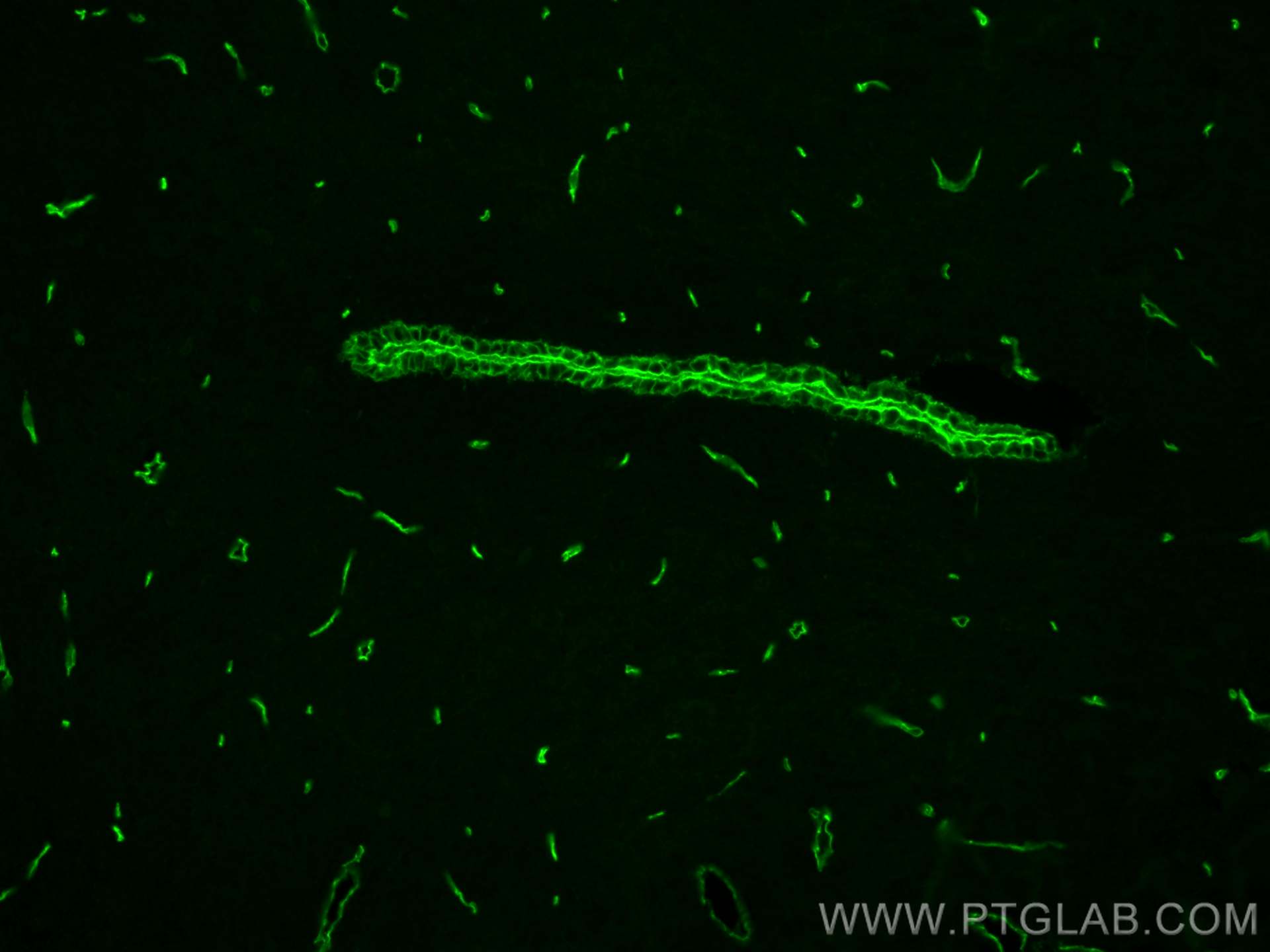Immunofluorescence (IF) / fluorescent staining of mouse brain tissue using CoraLite® Plus 488-conjugated GLUT1 Polyclonal ant (CL488-21829)