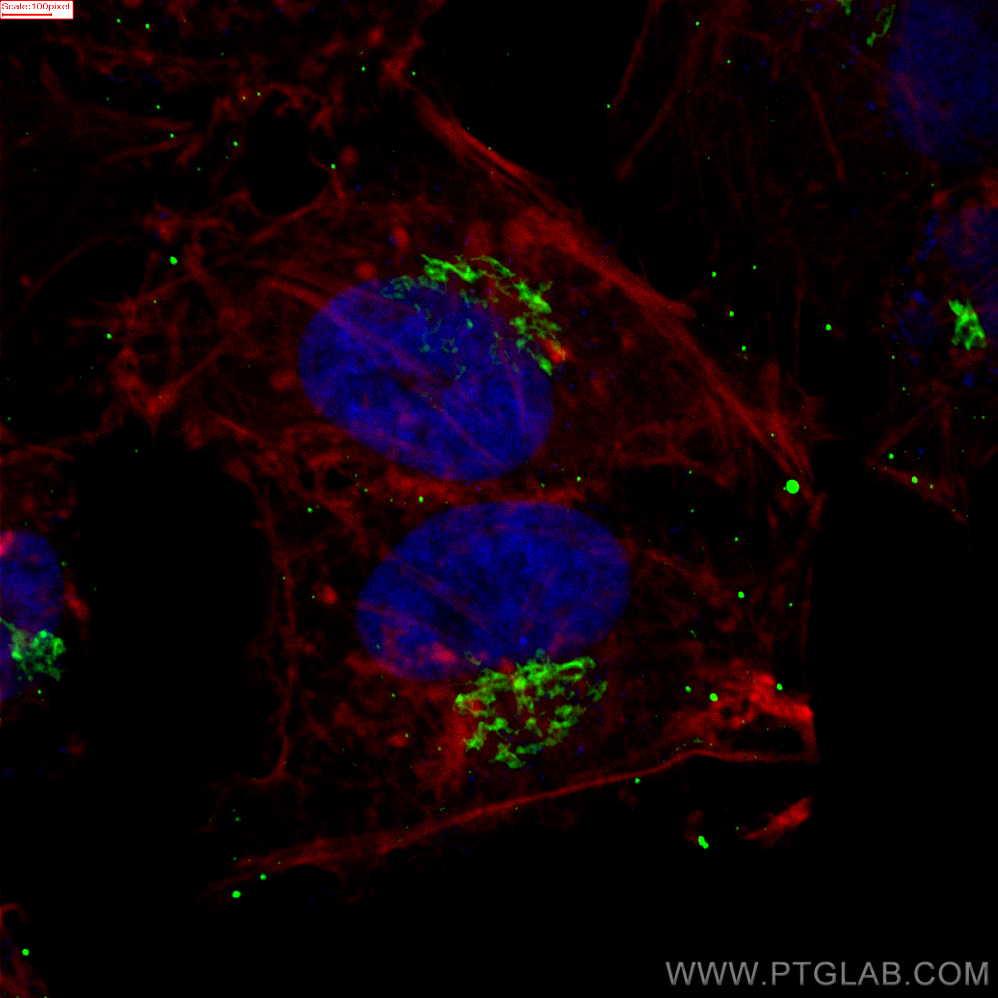 Immunofluorescence (IF) / fluorescent staining of HeLa cells using GOLGA2/GM130 Monoclonal antibody (66662-1-Ig)