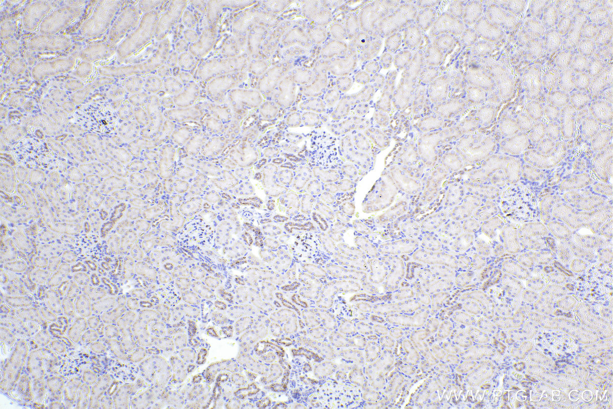 Immunohistochemistry (IHC) staining of rat kidney tissue using GOLGA2/GM130 Recombinant antibody (82705-8-RR)