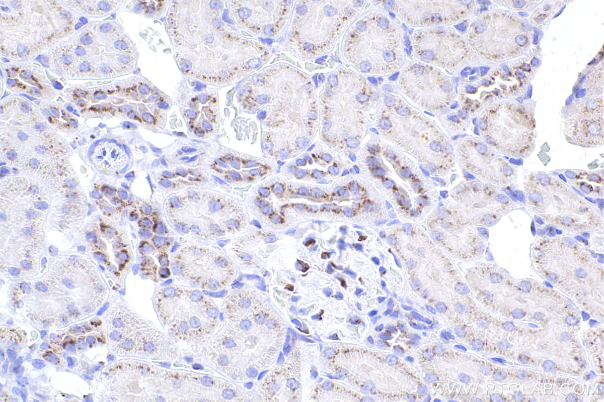 Immunohistochemistry (IHC) staining of rat kidney tissue using GOLGA2/GM130 Recombinant antibody (82705-8-RR)