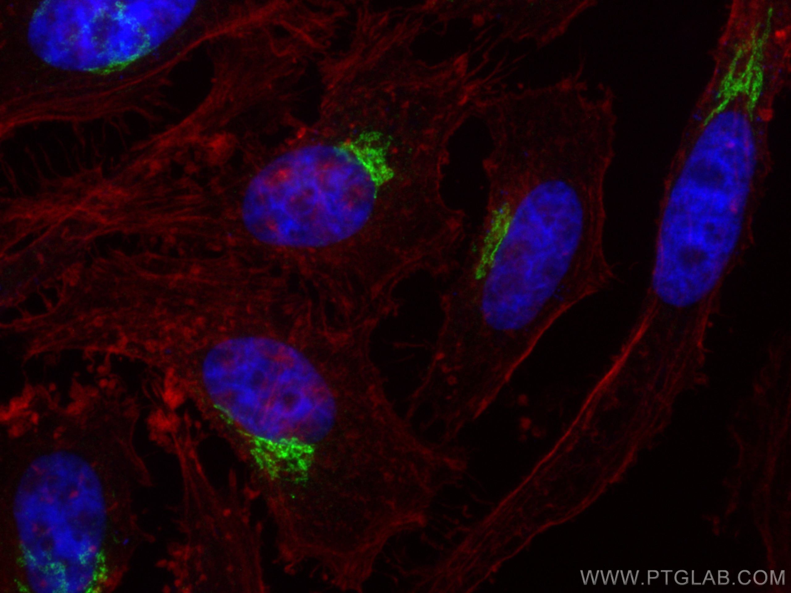 Immunofluorescence (IF) / fluorescent staining of HeLa cells using GMAP-210 Polyclonal antibody (26456-1-AP)