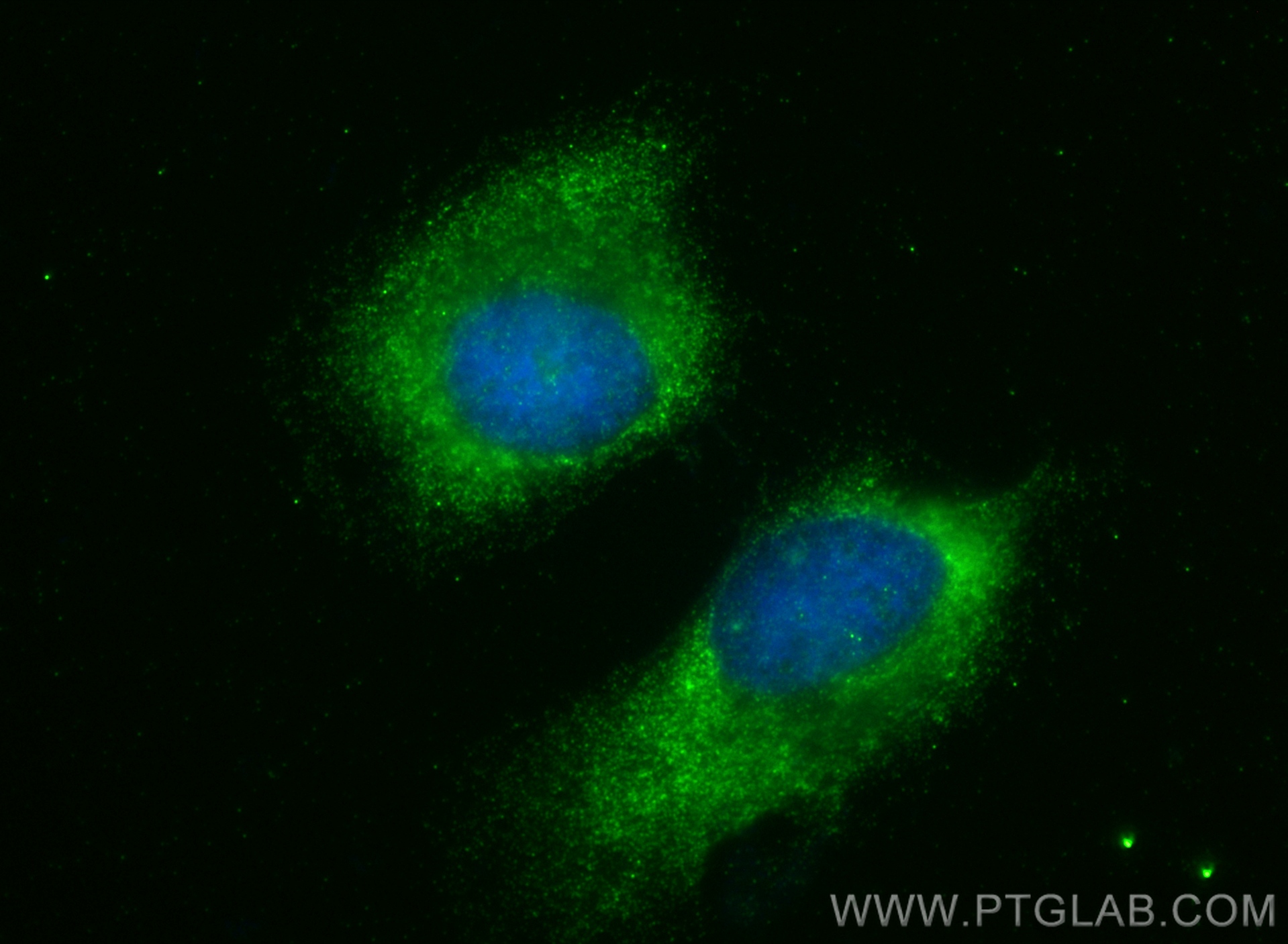 Immunofluorescence (IF) / fluorescent staining of HeLa cells using GMDS Polyclonal antibody (15442-1-AP)