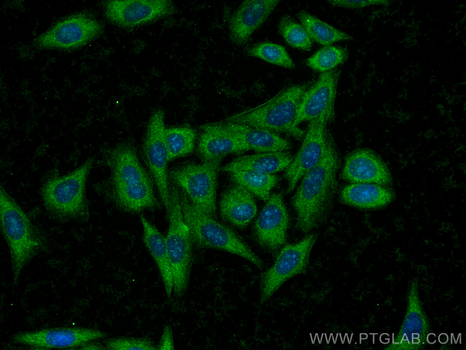 Immunofluorescence (IF) / fluorescent staining of HepG2 cells using GMIP Polyclonal antibody (25917-1-AP)