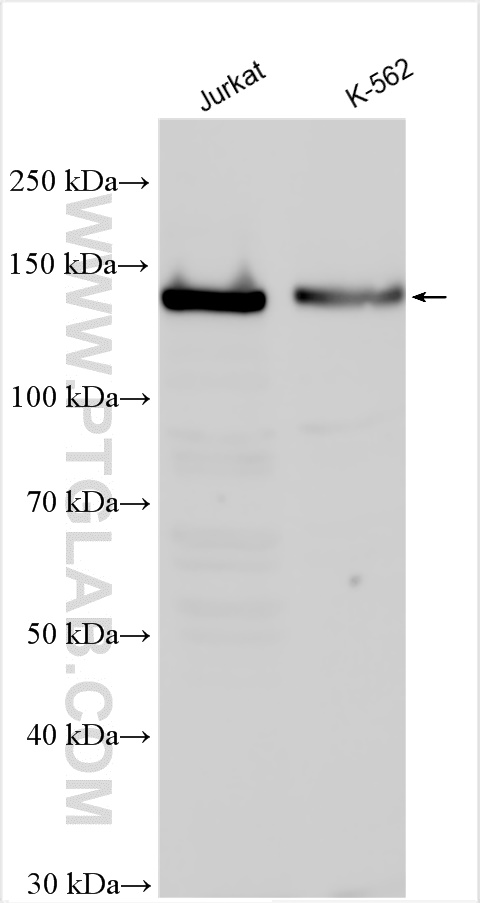 Western Blot (WB) analysis of various lysates using GMIP Polyclonal antibody (25917-1-AP)