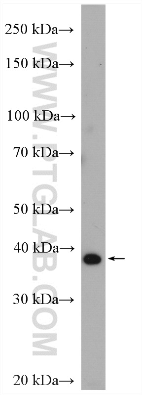 Western Blot (WB) analysis of rat brain tissue using GMPPB Polyclonal antibody (15094-1-AP)