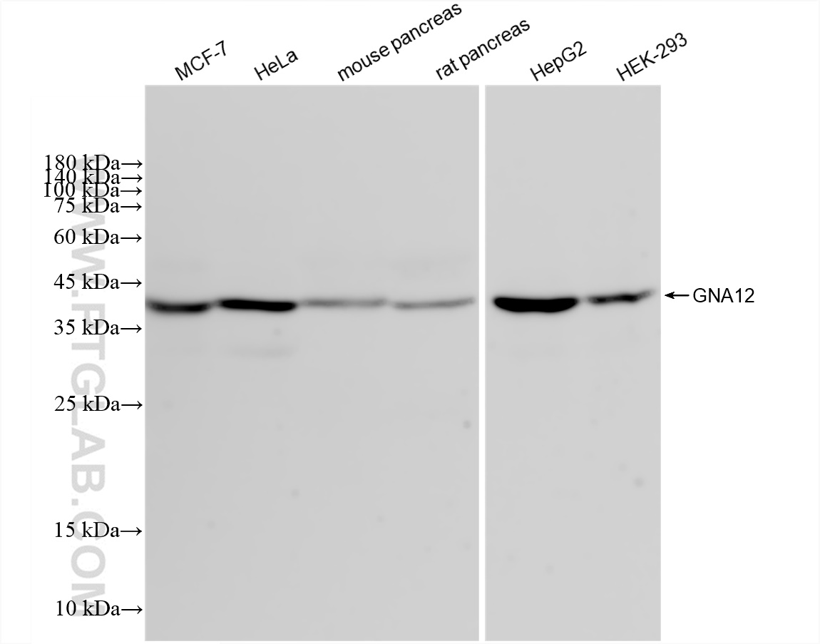 Western Blot (WB) analysis of various lysates using GNA12 Recombinant antibody (83263-4-RR)
