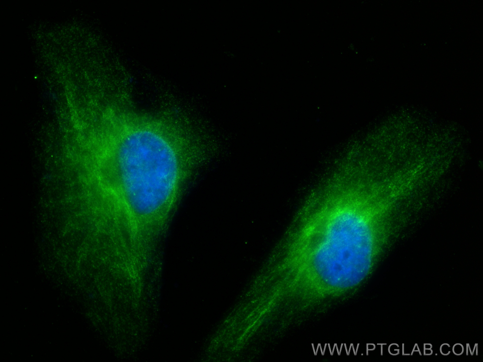 Immunofluorescence (IF) / fluorescent staining of HeLa cells using GNA14 Polyclonal antibody (13350-1-AP)