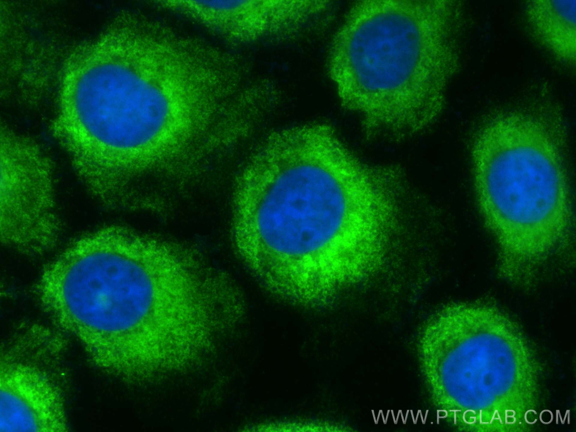 Immunofluorescence (IF) / fluorescent staining of A431 cells using CoraLite® Plus 488-conjugated GNAI2 Monoclonal ant (CL488-67007)