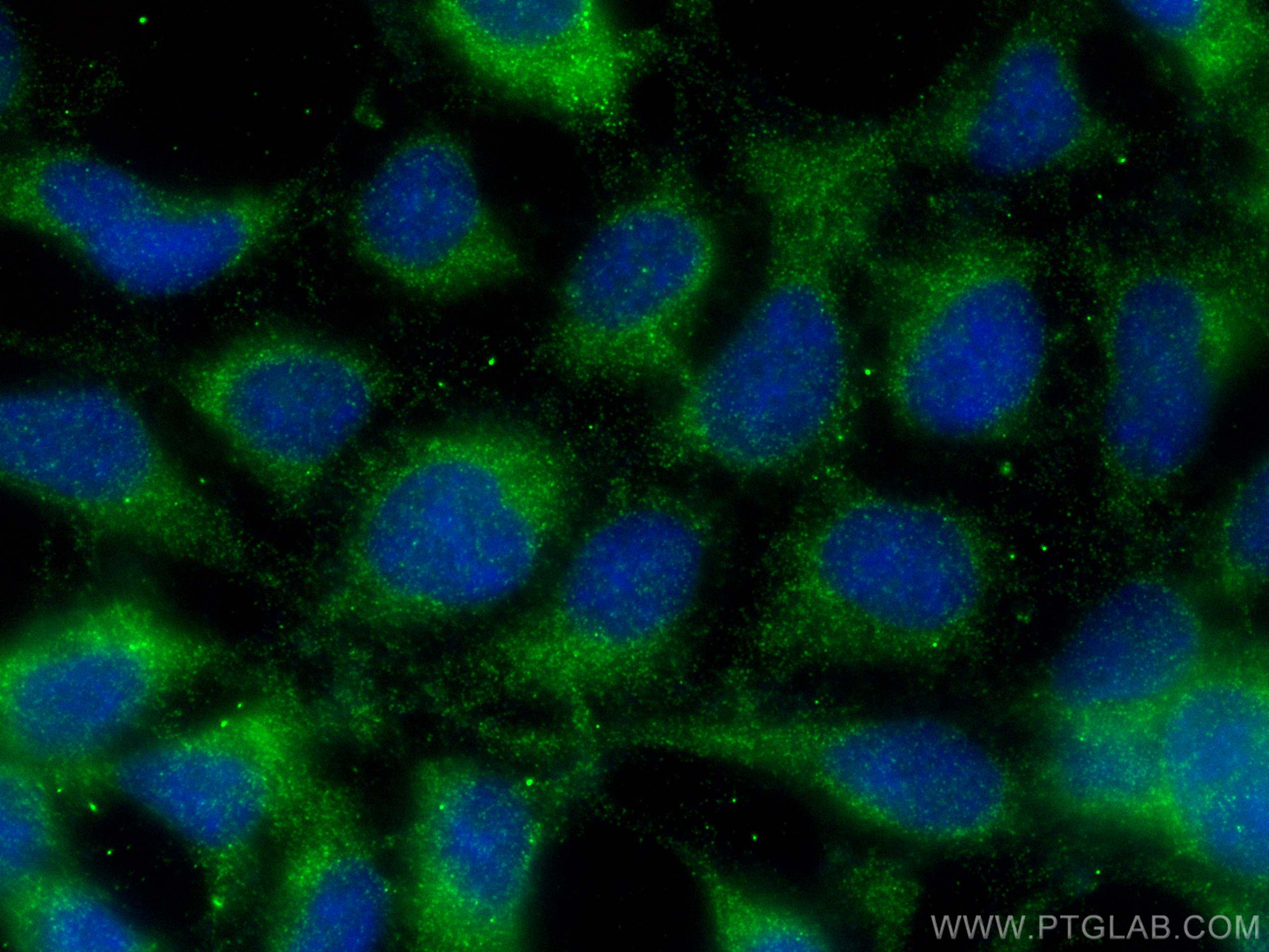 Immunofluorescence (IF) / fluorescent staining of HEK-293 cells using GNAQ Polyclonal antibody (13927-1-AP)