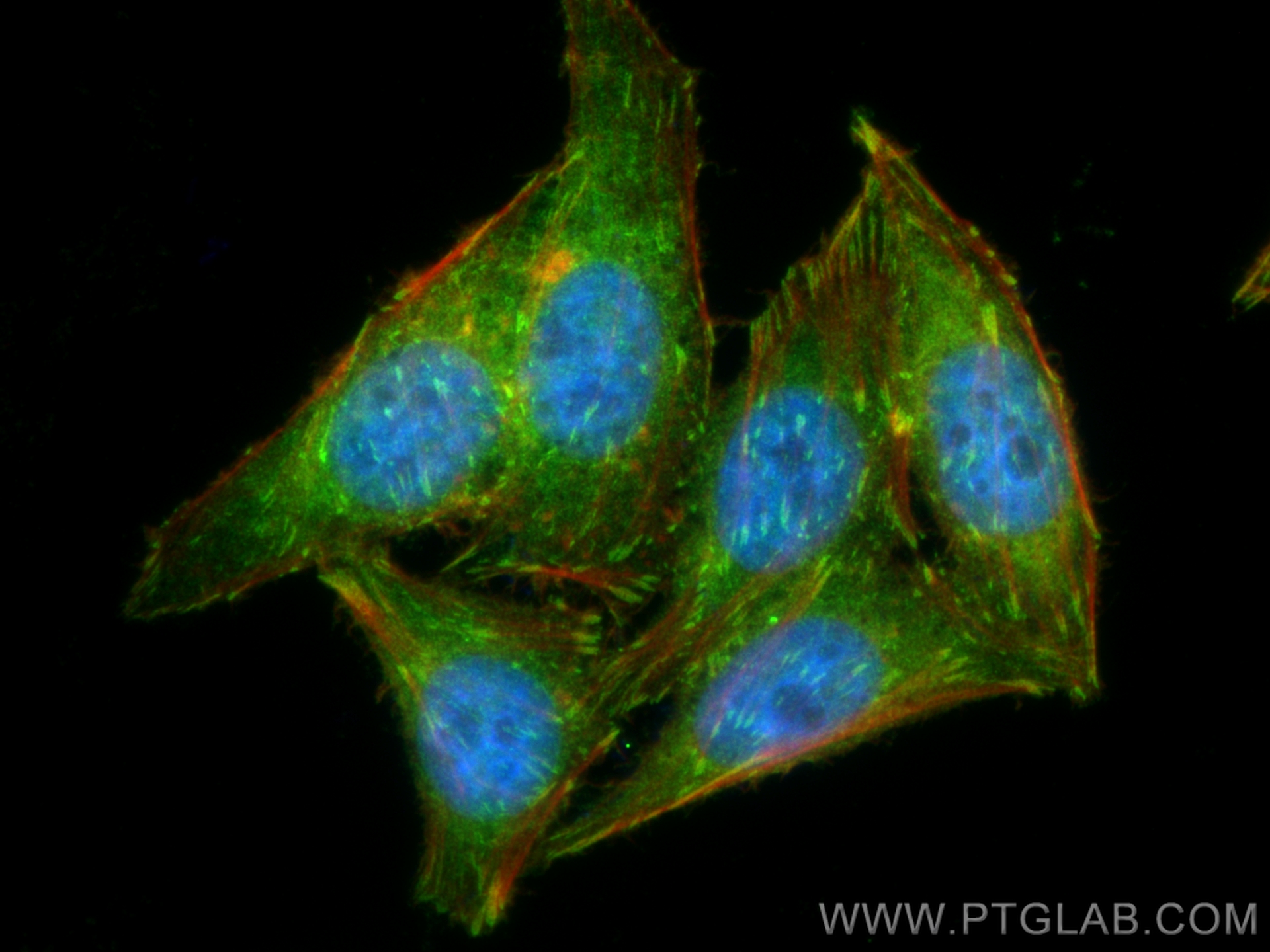 Immunofluorescence (IF) / fluorescent staining of HepG2 cells using GNB1 Polyclonal antibody (10247-2-AP)