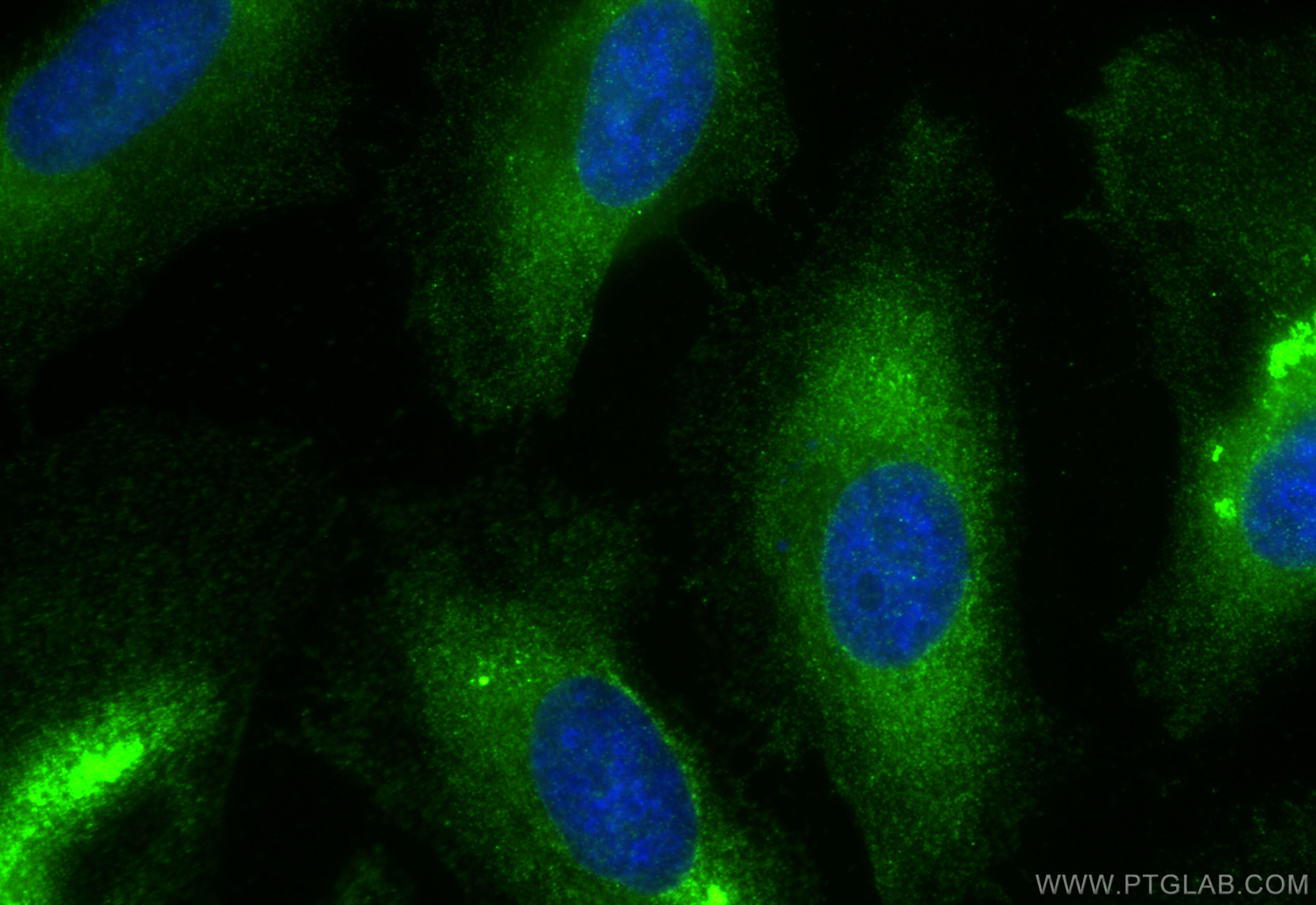 Immunofluorescence (IF) / fluorescent staining of HeLa cells using GNB2 Polyclonal antibody (16090-1-AP)