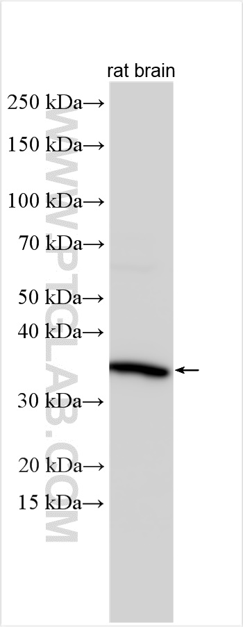 Western Blot (WB) analysis of various lysates using GNB3 Polyclonal antibody (10081-1-AP)