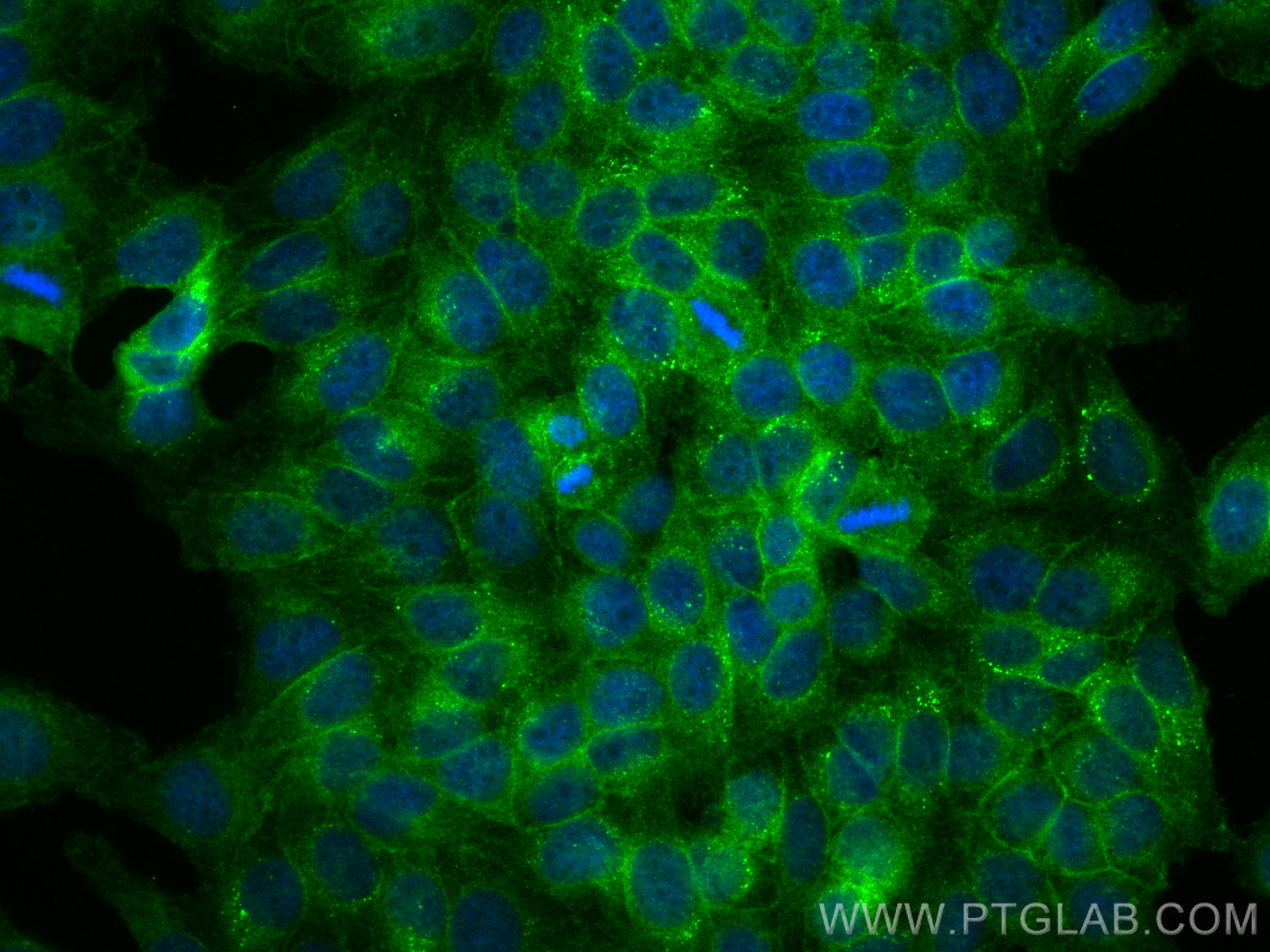 Immunofluorescence (IF) / fluorescent staining of HepG2 cells using GNB4 Polyclonal antibody (11978-2-AP)