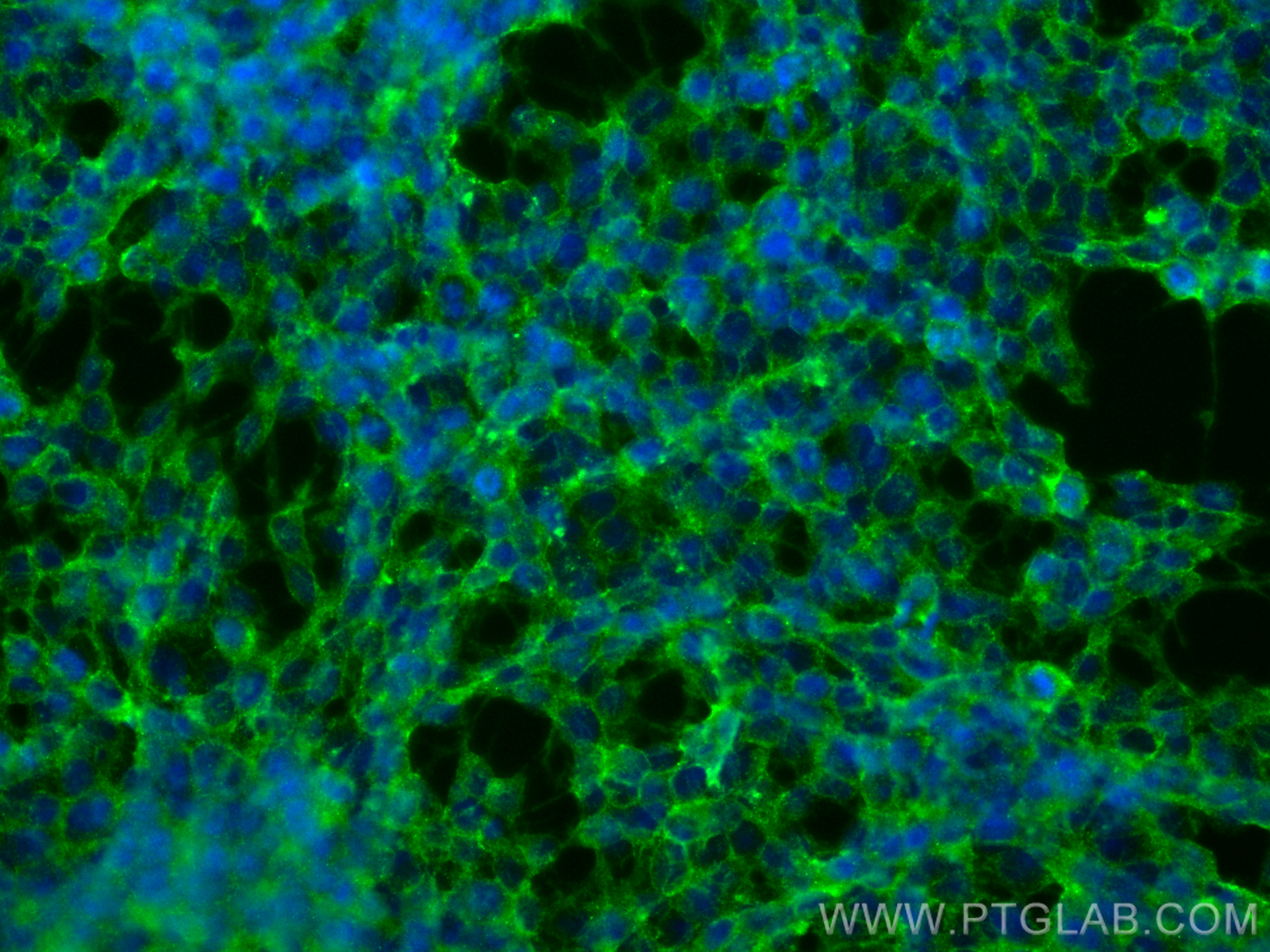 Immunofluorescence (IF) / fluorescent staining of SH-SY5Y cells using GNB4 Polyclonal antibody (11978-2-AP)