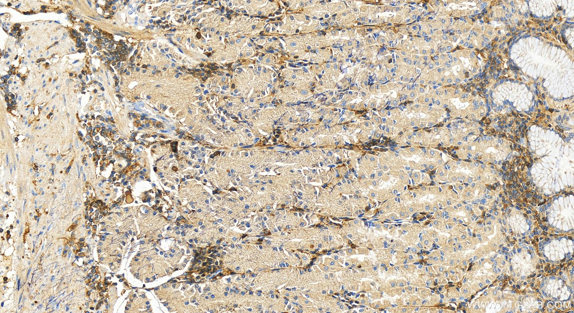 Immunohistochemistry (IHC) staining of human stomach tissue using GNG2 Polyclonal antibody (11693-1-AP)