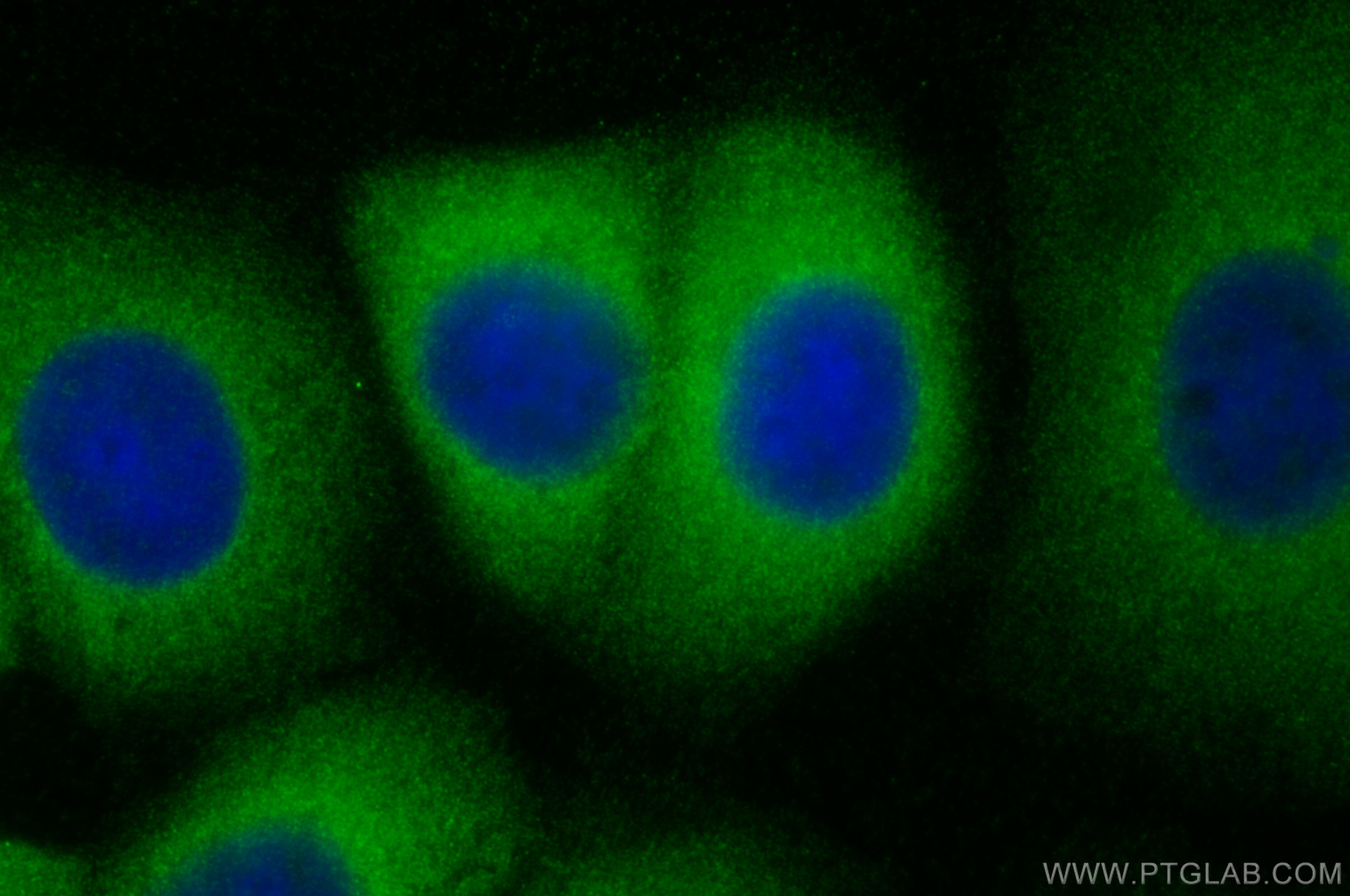 Immunofluorescence (IF) / fluorescent staining of MCF-7 cells using GNL1 Polyclonal antibody (14078-1-AP)