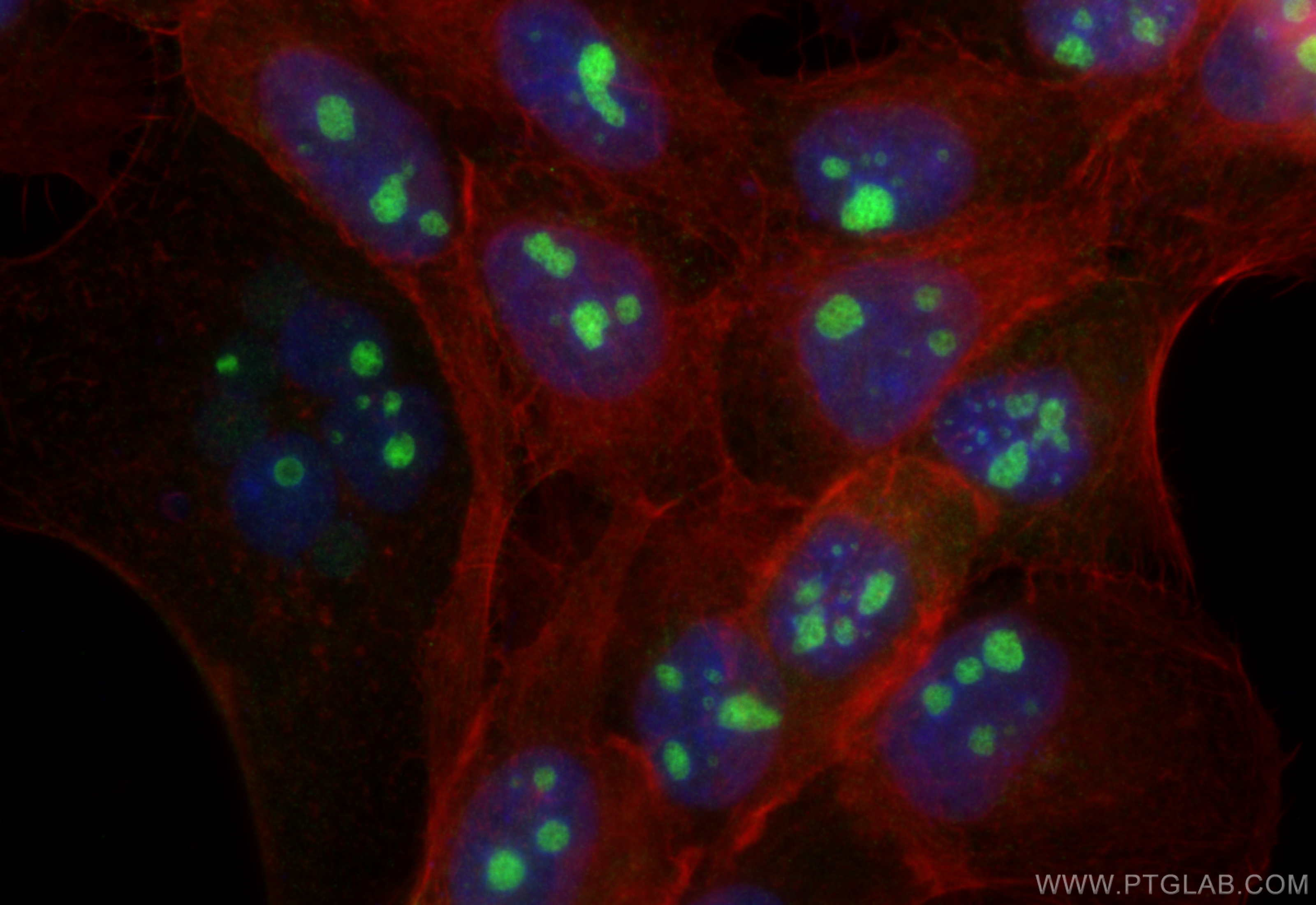 Immunofluorescence (IF) / fluorescent staining of A431 cells using GNL2 Polyclonal antibody (10190-2-AP)