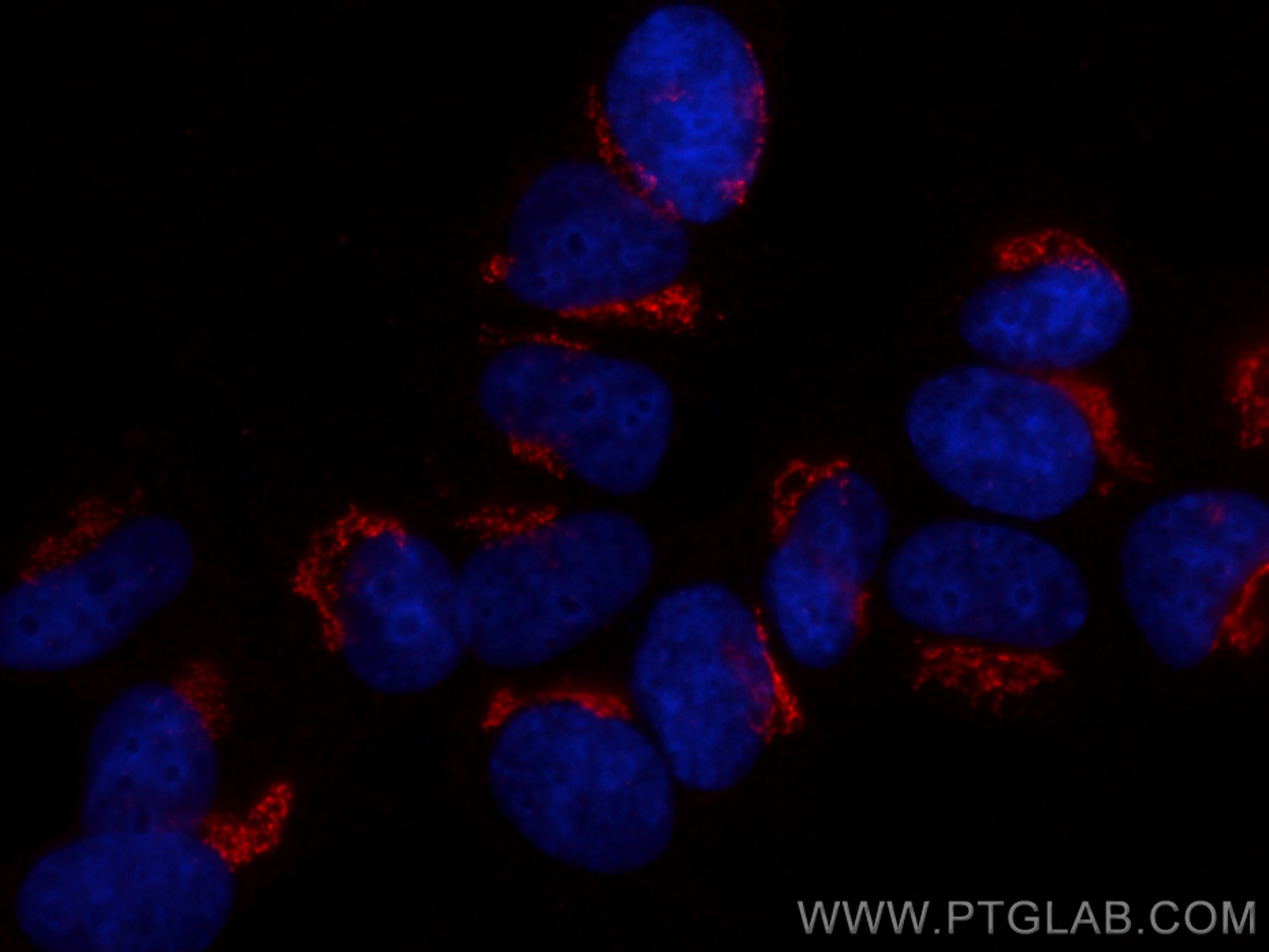 Immunofluorescence (IF) / fluorescent staining of MCF-7 cells using golgin 97 Monoclonal antibody (68648-1-Ig)
