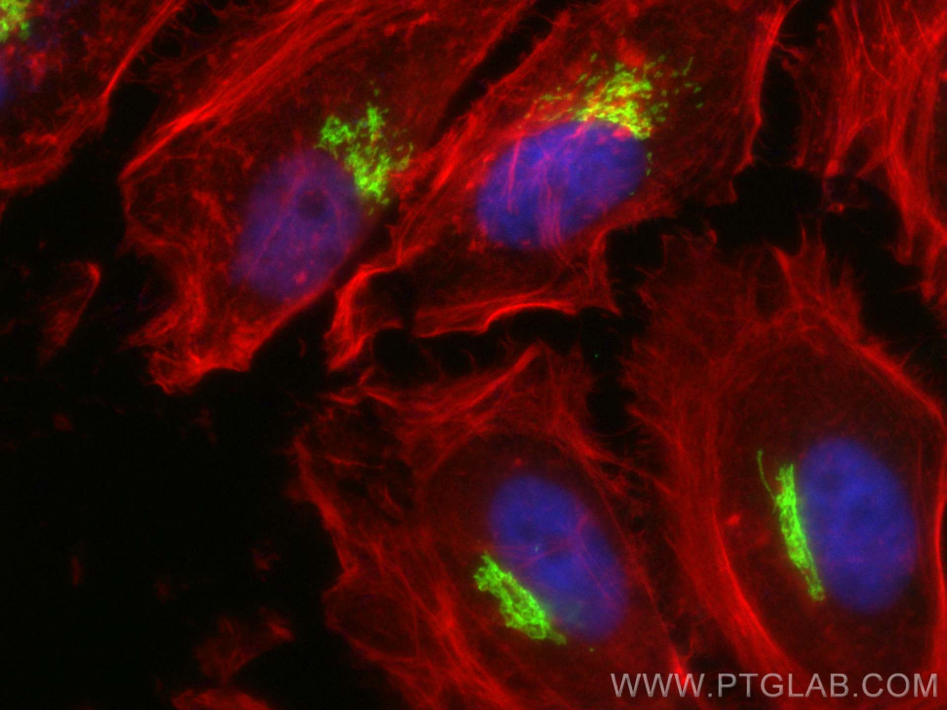 Immunofluorescence (IF) / fluorescent staining of HeLa cells using GOLGA2/GM130 Polyclonal antibody (11308-1-AP)