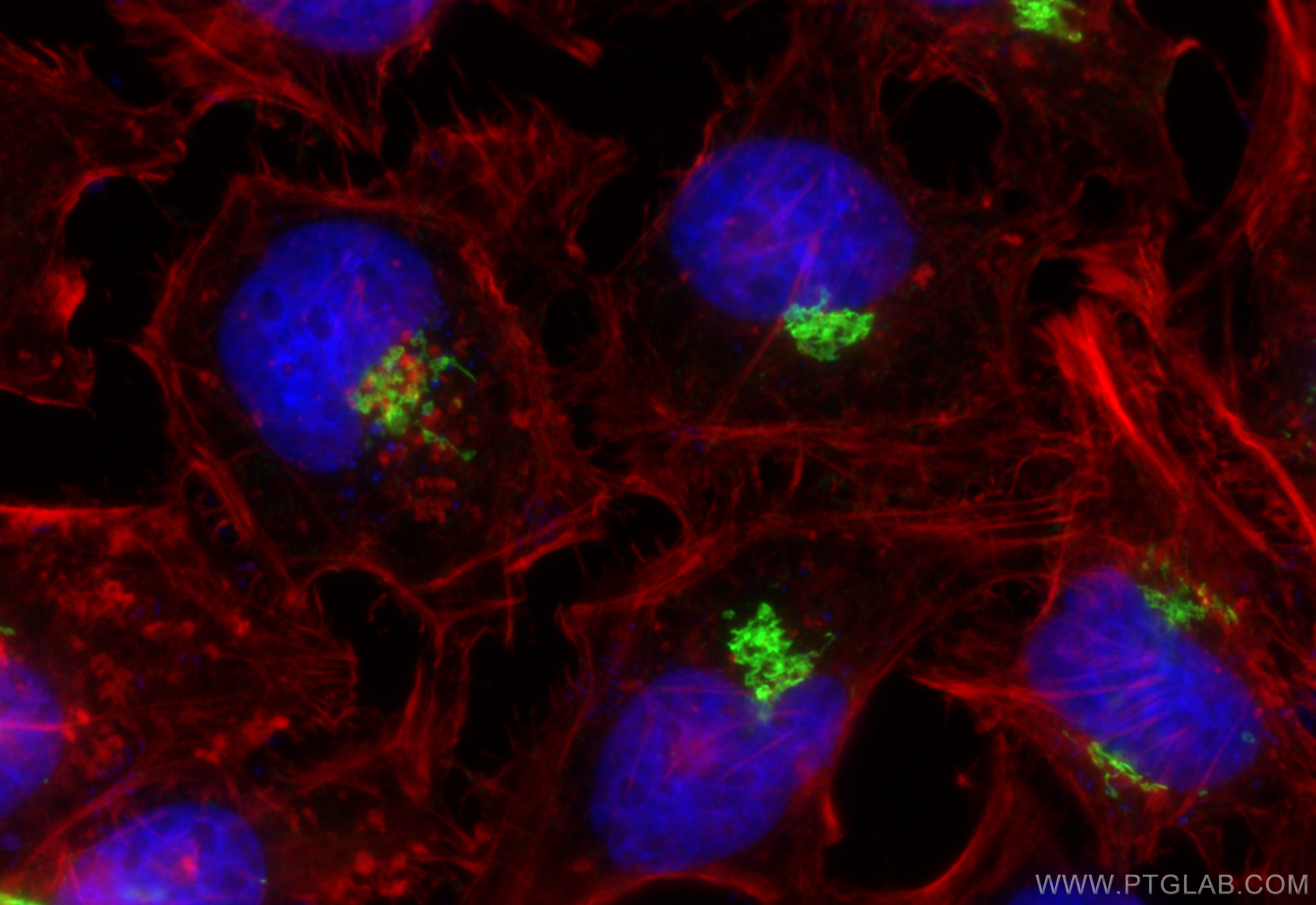 Immunofluorescence (IF) / fluorescent staining of HeLa cells using GOLGA2/GM130 Polyclonal antibody (11308-1-AP)