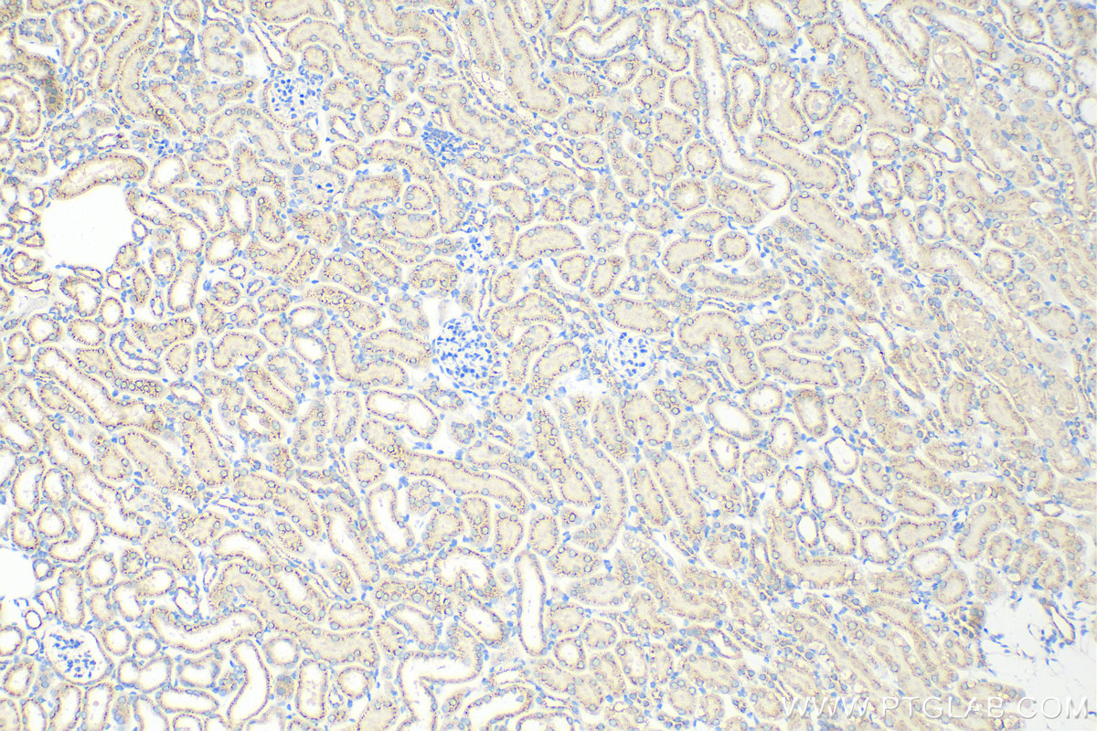 Immunohistochemistry (IHC) staining of mouse kidney tissue using GOLGA2/GM130 Polyclonal antibody (11308-1-AP)