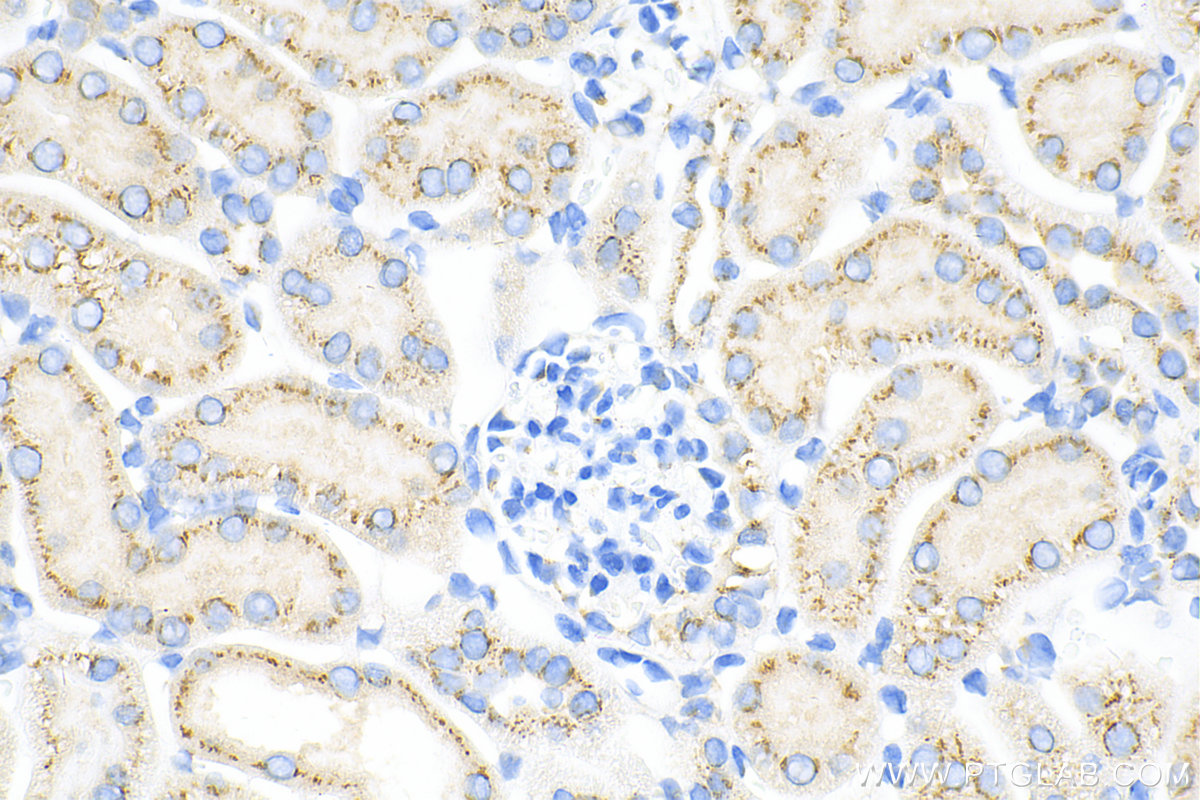 Immunohistochemistry (IHC) staining of mouse kidney tissue using GOLGA2/GM130 Polyclonal antibody (11308-1-AP)