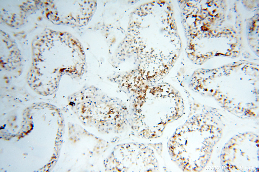 Immunohistochemistry (IHC) staining of human testis tissue using GOLGA2/GM130 Polyclonal antibody (11308-1-AP)